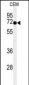 MFSD6 Antibody  (C-term)